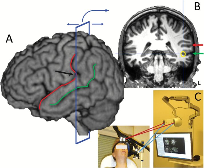 Fig. 2.