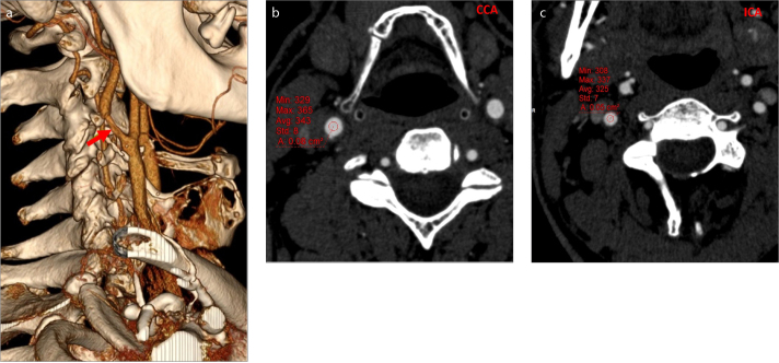 Figure 3. a–c