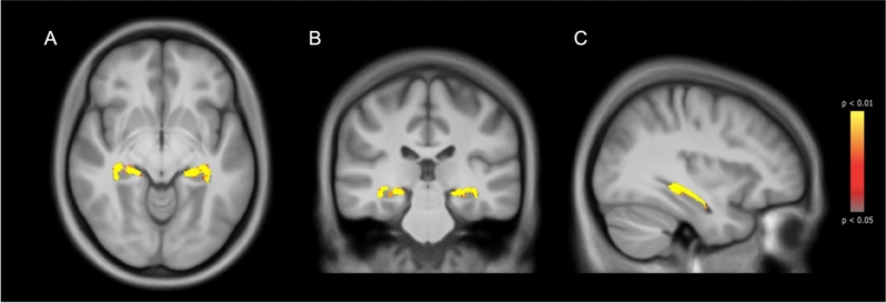 Fig. 2