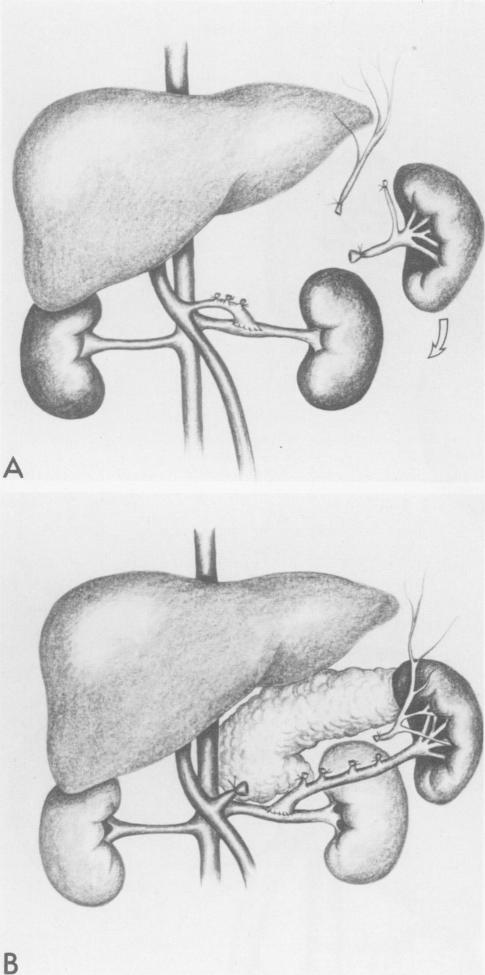 Figs. 3A and B.