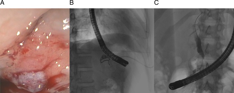 Figure 2