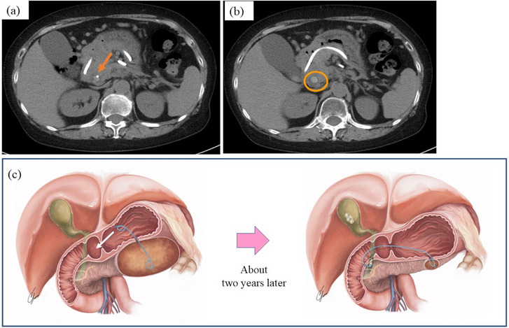 FIGURE 2