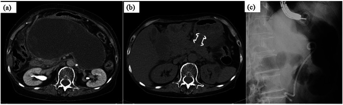 FIGURE 1