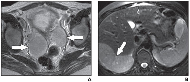 Fig. 12