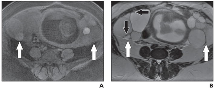 Fig. 11