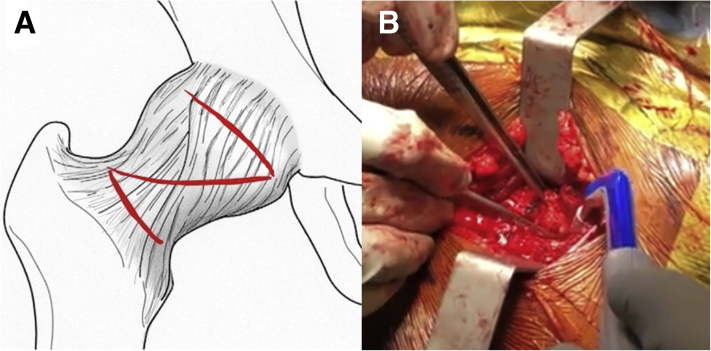 Fig 2