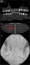 Fig. 4