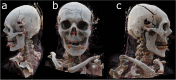 Fig. 7