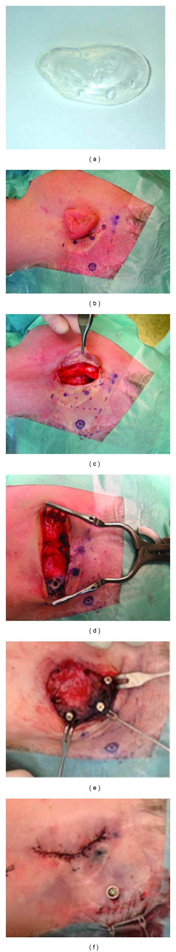 Figure 11