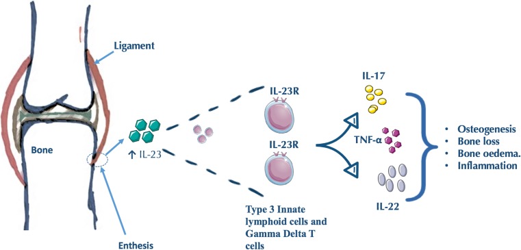 Enthesitis: Much More Than Focal Insertion Point Inflammation - PMC