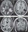 Fig 1.
