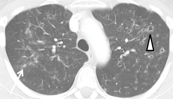 graphic file with name 15033_2017_557_Fig12_HTML.jpg