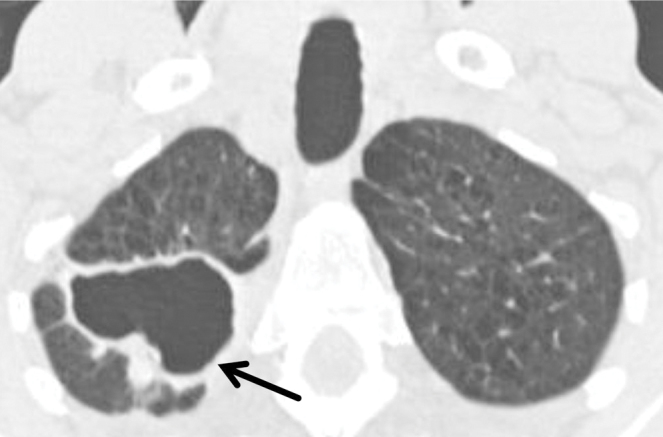 graphic file with name 15033_2017_557_Fig13_HTML.jpg