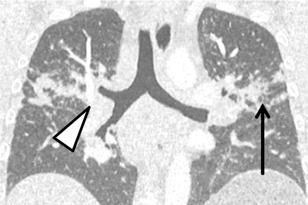 graphic file with name 15033_2017_557_Fig2_HTML.jpg