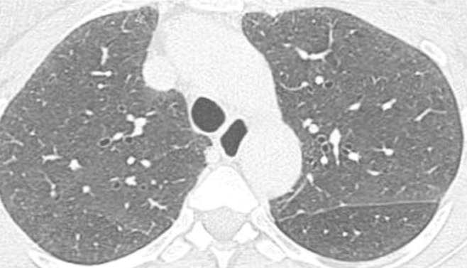 graphic file with name 15033_2017_557_Fig6_HTML.jpg