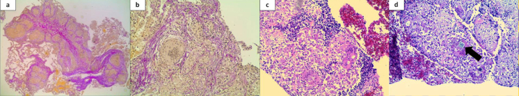 graphic file with name 15033_2017_557_Fig1_HTML.jpg