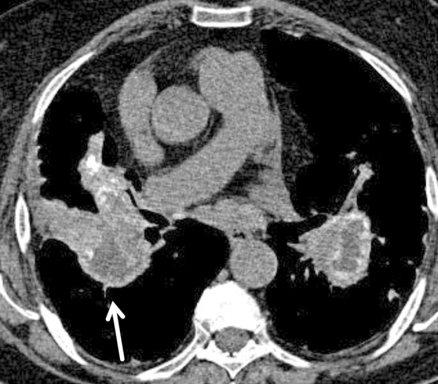 graphic file with name 15033_2017_557_Fig11_HTML.jpg