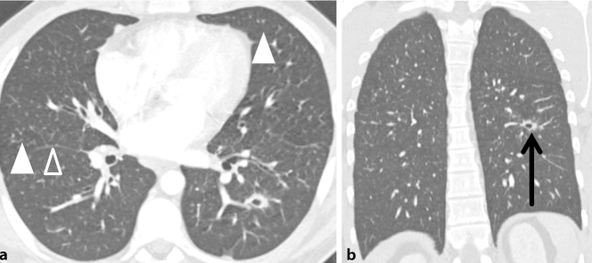graphic file with name 15033_2017_557_Fig3_HTML.jpg