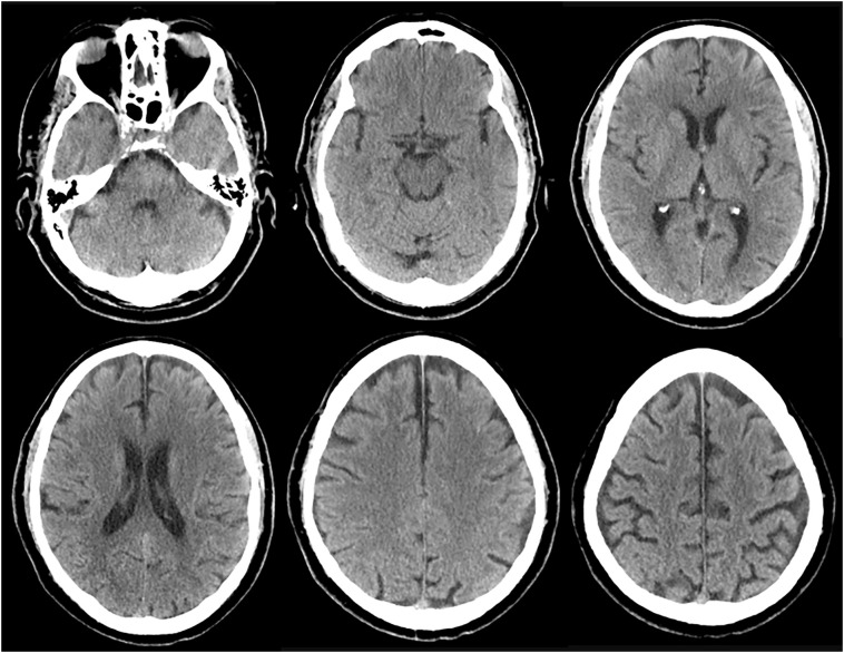 Fig. 1