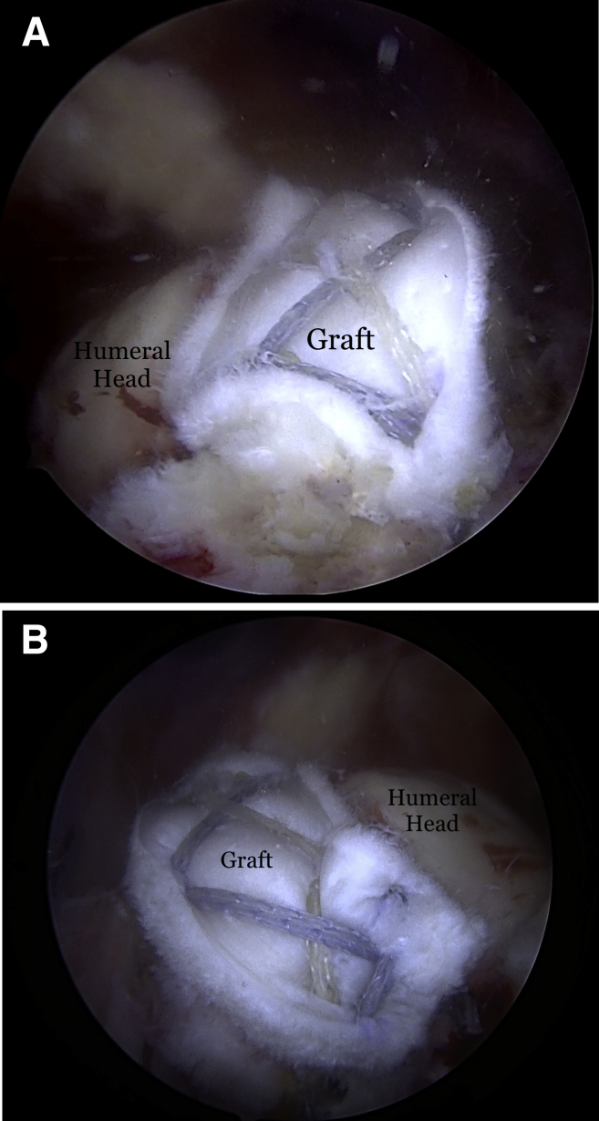 Fig 11