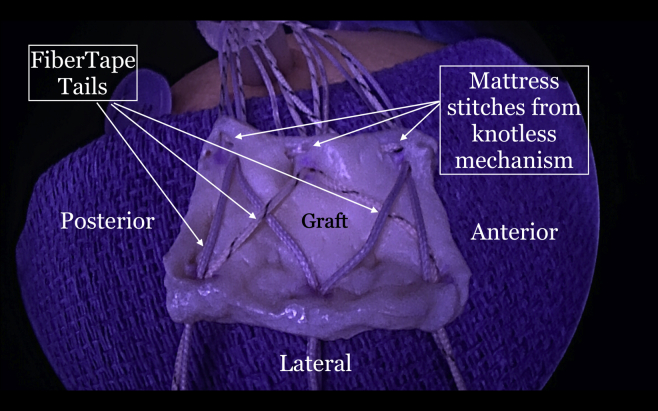 Fig 8