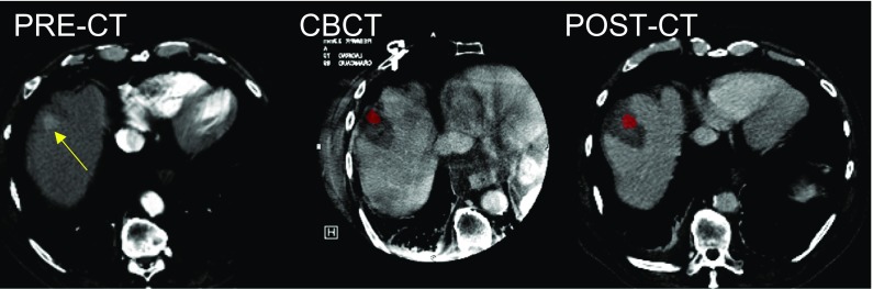 Fig. 2