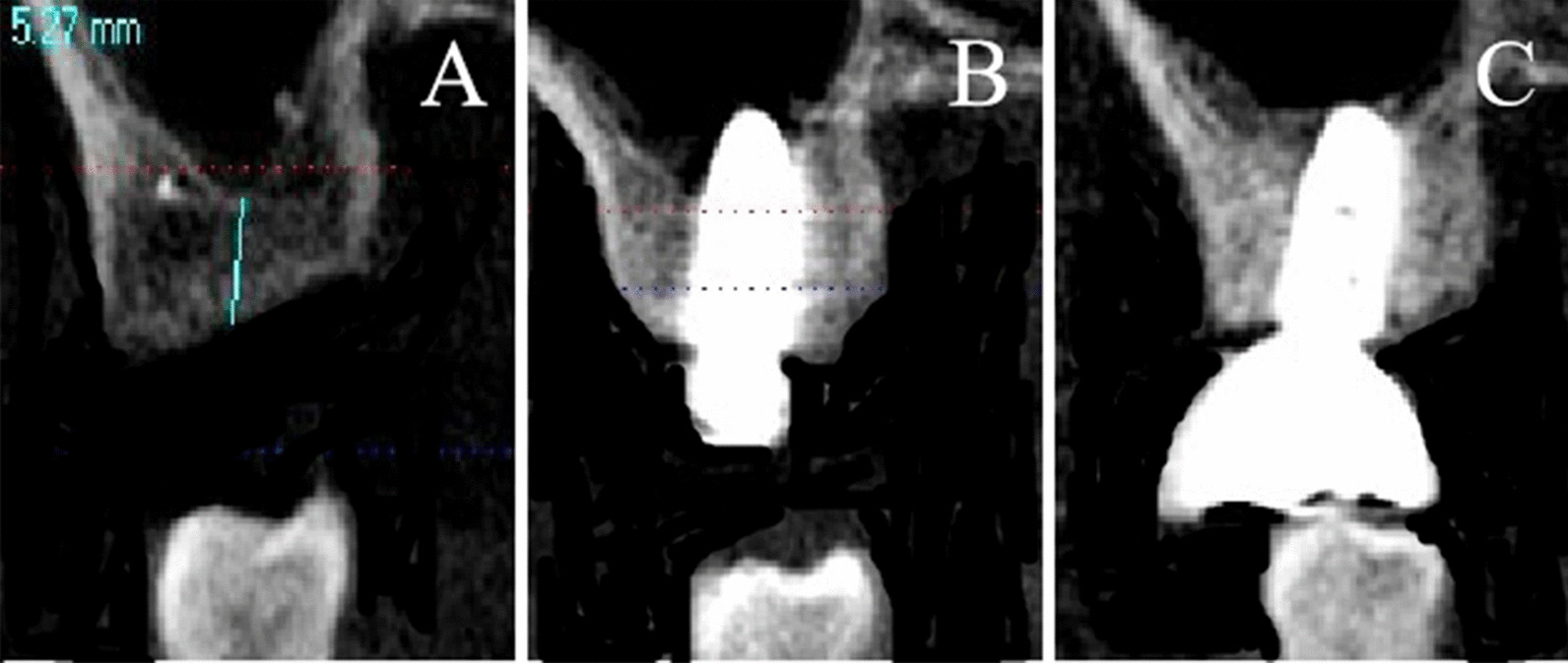 Fig. 2