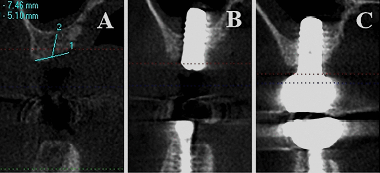 Fig. 3