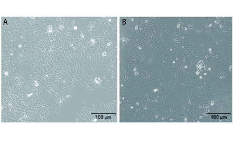 A：HCC-827细胞; B：1.0 <italic>μ</italic>mol/mL吉非替尼耐药细胞HCC-827/GR（相差显微镜×100）。 A: HCC-827 cells; B: 1.0 <italic>μ</italic>mol/mL gefitinib-resistant cell hcc-827/GR (phase difference microscope×100).