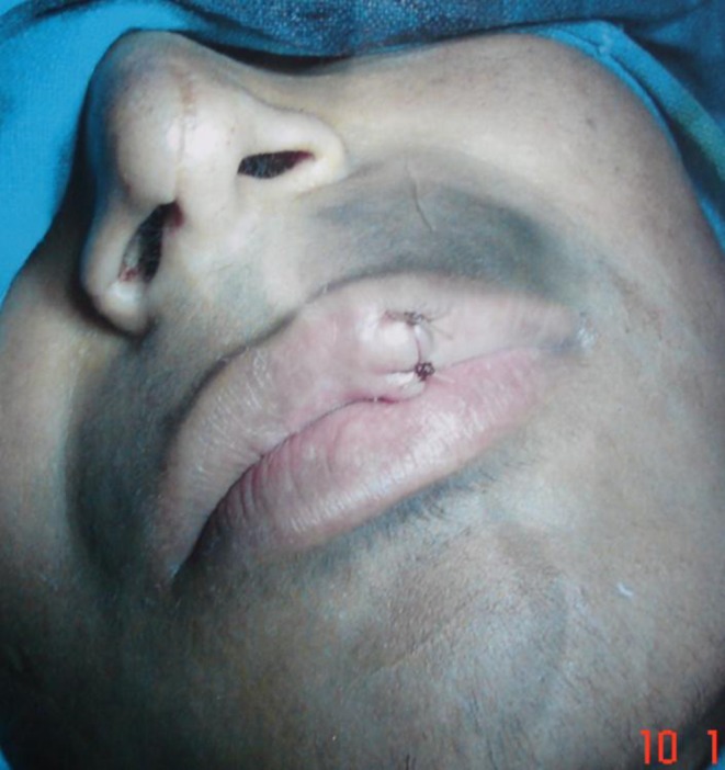 Fig. 6