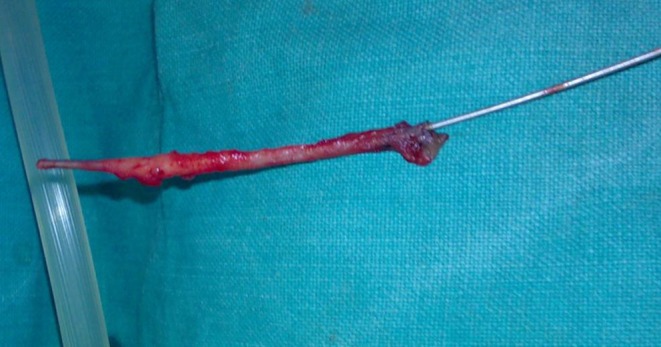 Fig. 5