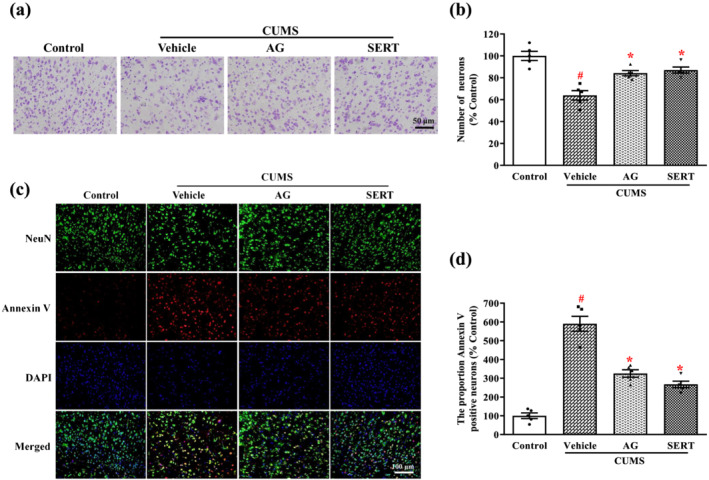 FIGURE 4