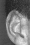 Fig. 14