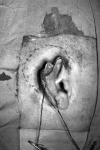Fig. 10