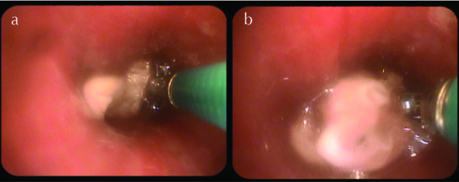 Figure 4. a, b