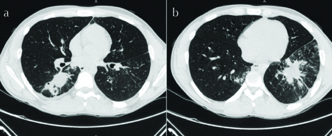 Figure 2. a, b