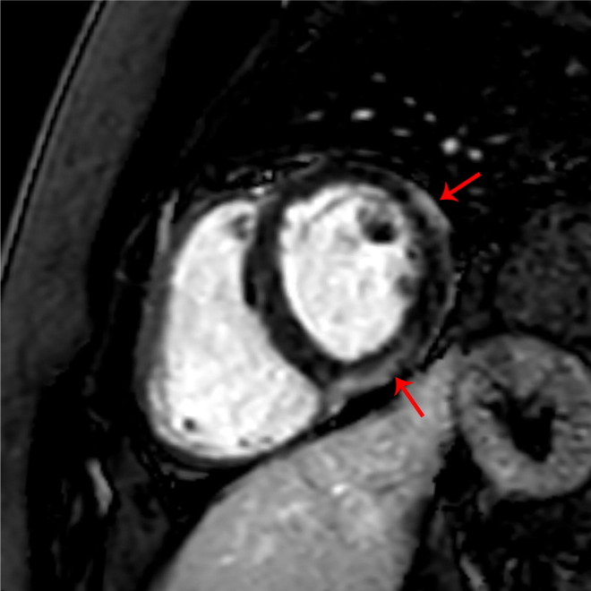 Fig. 2