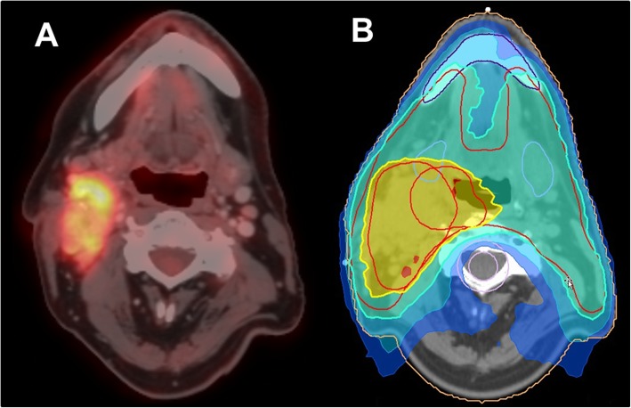 Fig. 2