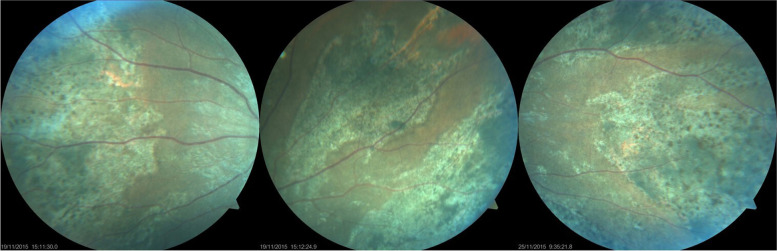 Fig. 3