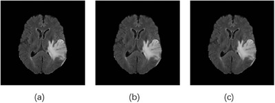 FIGURE 10