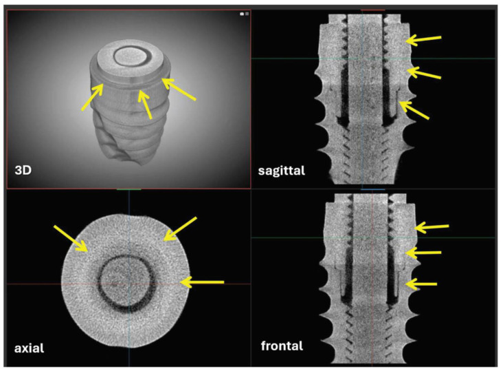 Figure 5