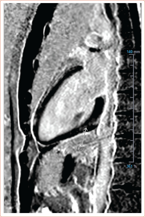 Figure 3: