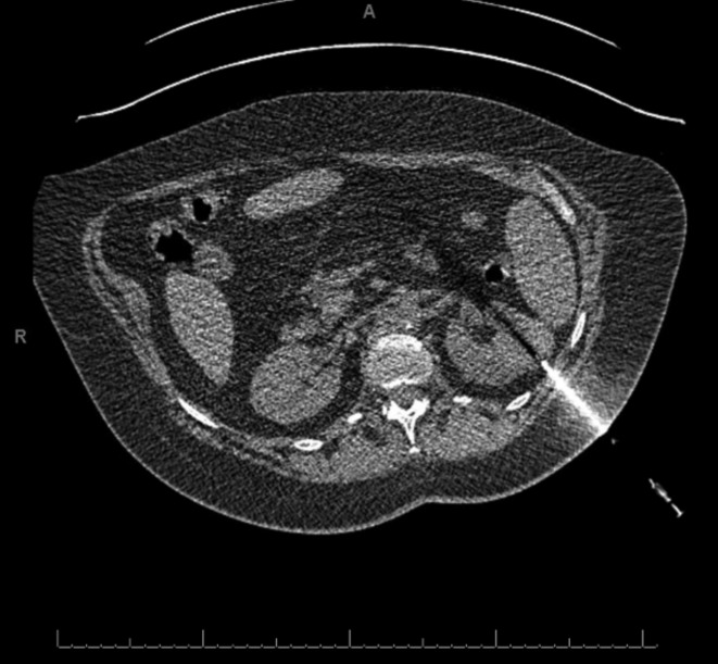 Fig. 1a.