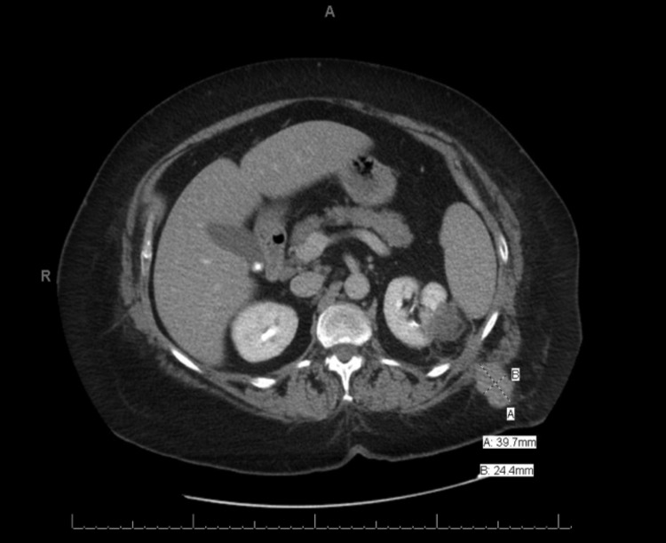 Fig. 1b.