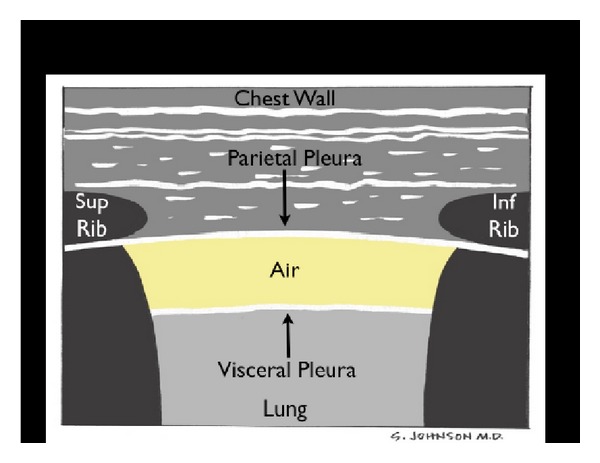 Figure 21