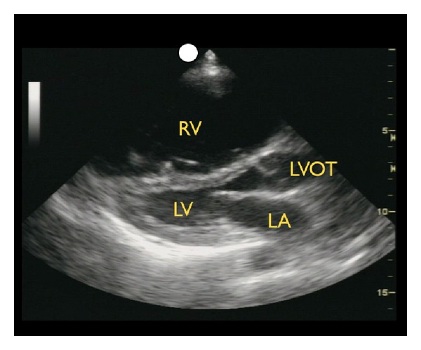 Figure 11