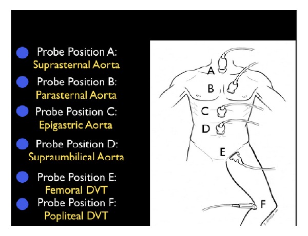 Figure 23