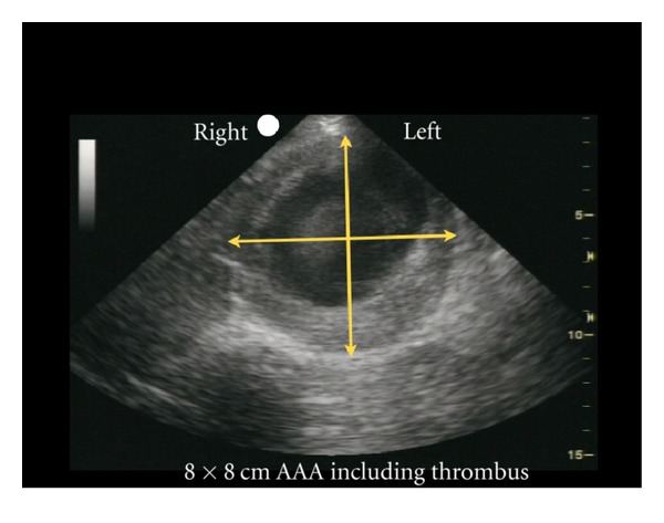 Figure 25