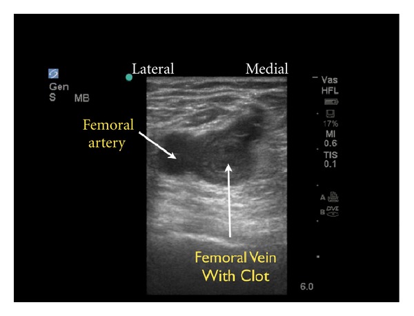 Figure 28