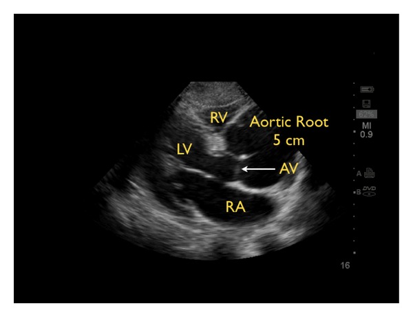 Figure 26